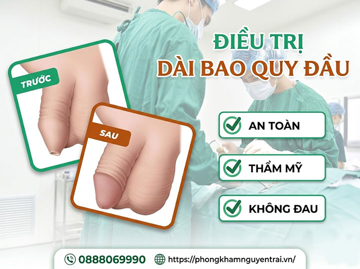 Bệnh dài bao quy đầu: Nguyên nhân, triệu chứng và cách chữa 9 cách chữa bệnh dài bao quy đầu