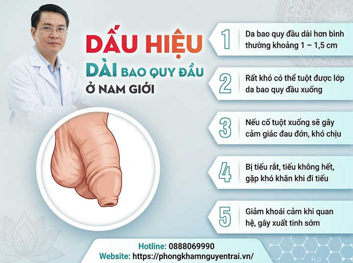 Bệnh dài bao quy đầu: Nguyên nhân, triệu chứng và cách chữa 6 dấu hiệu bệnh dài bao quy đầu