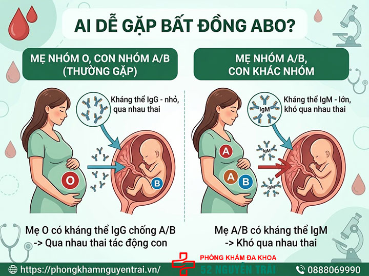 Bất đồng nhóm máu mẹ con: Nguy cơ & cách xử lý 4 Ai dễ gặp bất đồng ABO?