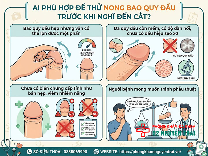 Cách Nong Bao Quy Đầu Cho Người Lớn An Toàn, Hiệu Quả 2 Ai phù hợp để thử nong bao quy đầu trước khi nghĩ đến cắt?