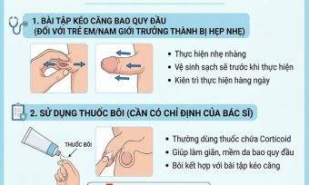 Ảnh minh hoạ Cách chữa hẹp bao quy đầu tại nhà