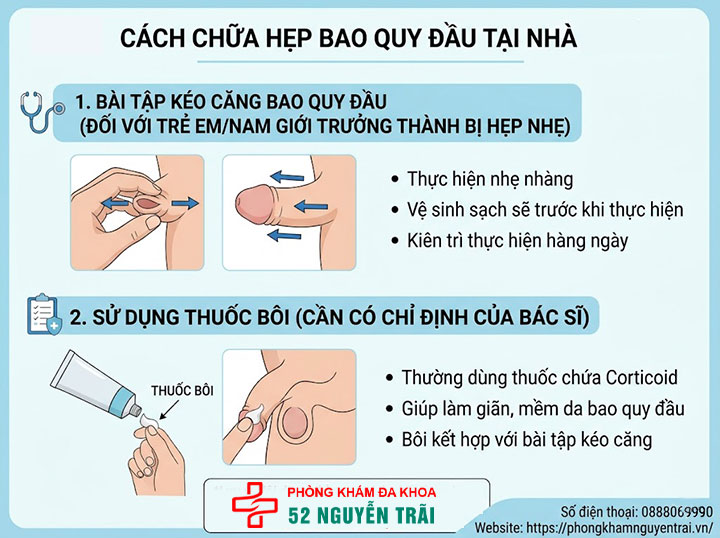 Cách chữa hẹp bao quy đầu tại nhà: Hiệu quả hay rủi ro? 2 Ảnh minh hoạ Cách chữa hẹp bao quy đầu tại nhà
