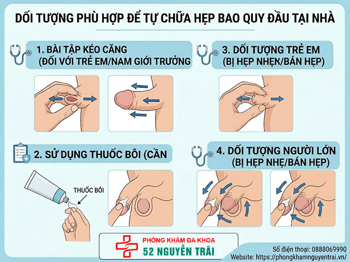 Cách chữa hẹp bao quy đầu tại nhà: Hiệu quả hay rủi ro? 4 Ảnh minh hoạ Đối tượng phù hợp để tự chữa hẹp bao quy đầu tại nhà