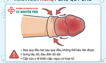 Ảnh minh hoạ: Nghẹt bao quy đầu