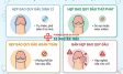 Các mức độ hẹp bao quy đầu và quy trình cắt thẩm mỹ