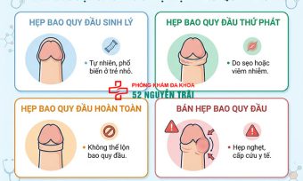 Ảnh minh hoạ: Phân loại các mức độ hẹp bao quy đầu