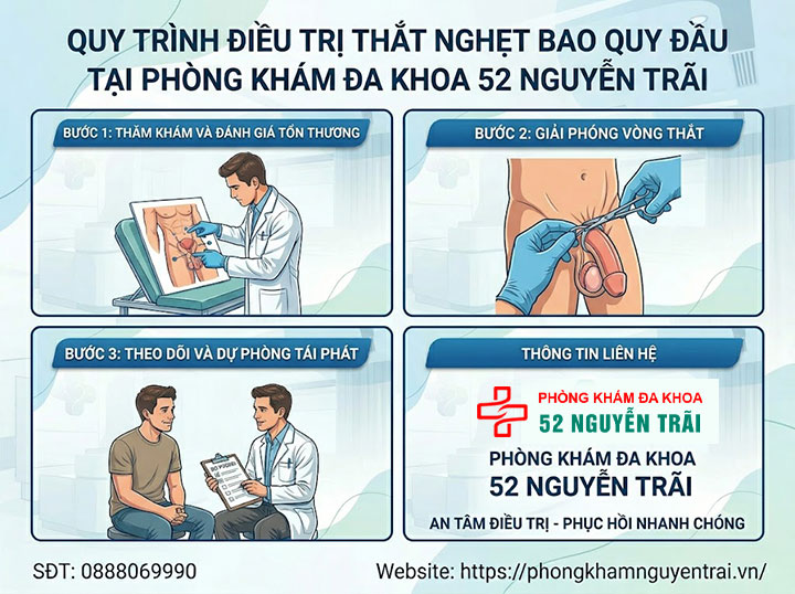 Cách chữa nghẹt bao quy đầu an toàn: Cảnh báo từ bác sĩ chuyên khoa 7 Ảnh minh hoạ: Quy trình điều trị thắt nghẹt bao quy đầu