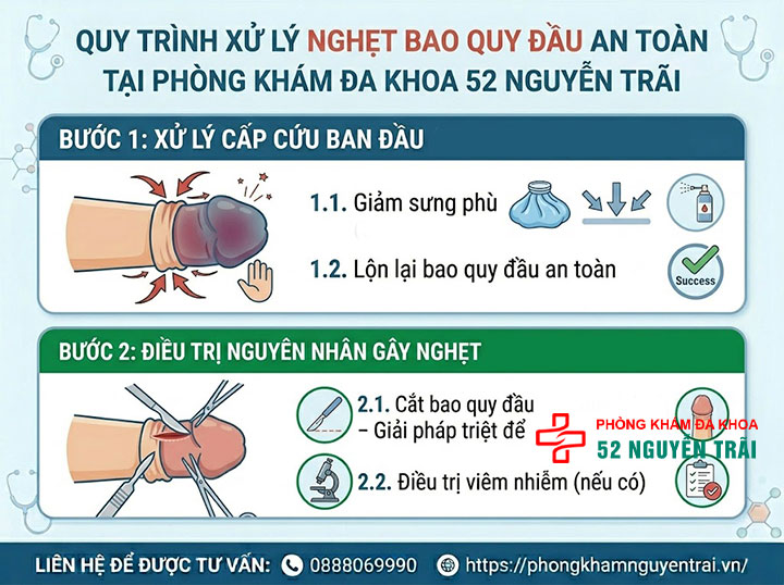 Nghẹt bao quy đầu là gì? Dấu hiệu và cách cấp cứu khẩn cấp 6 Ảnh minh hoạ: Quy trình xử lý nghẹt bao quy đầu