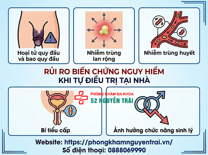 Cách chữa nghẹt bao quy đầu tại nhà: Cảnh báo từ chuyên gia 6 Ảnh minh hoạ: Rủi ro biến chứng nguy hiểm khi tự điều trị tại nhà