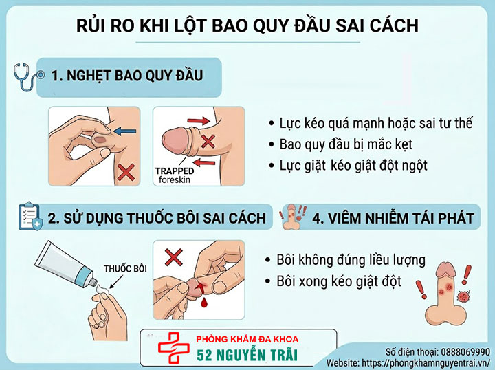 Cách chữa hẹp bao quy đầu tại nhà: Hiệu quả hay rủi ro? 5 Ảnh minh hoạ Rủi ro khi lột bao quy đầu sai cách