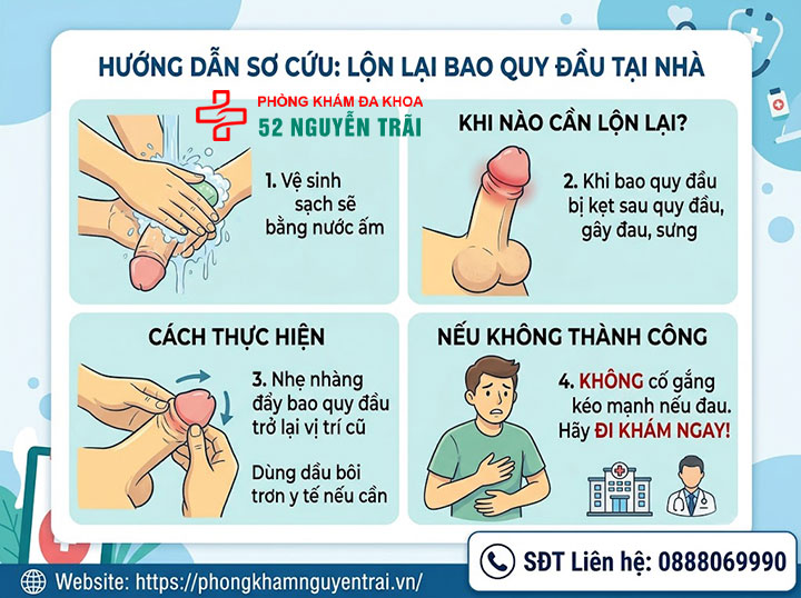 Cách chữa nghẹt bao quy đầu tại nhà: Cảnh báo từ chuyên gia 3 Ảnh minh hoạ: Sơ cứu bằng cách lộn lại bao quy đầu tại nhà