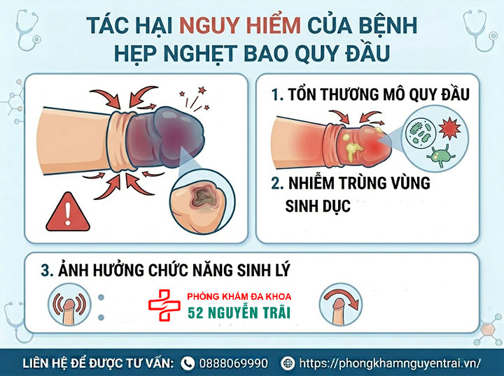 Nghẹt bao quy đầu là gì? Dấu hiệu và cách cấp cứu khẩn cấp 5 Ảnh minh hoạ: Tác hại nguy hiểm của bệnh hẹp nghẹt bao quy đầu