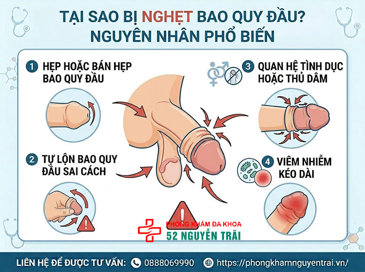 Nghẹt bao quy đầu là gì? Dấu hiệu và cách cấp cứu khẩn cấp 4 Ảnh minh hoạ: Tại sao bị nghẹt bao quy đầu