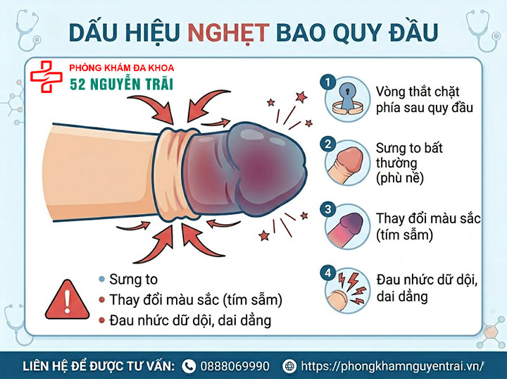 Nghẹt bao quy đầu là gì? Dấu hiệu và cách cấp cứu khẩn cấp 3 Ảnh minh hoạ: dấu hiệu bị nghẹt bao quy đầu