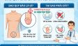 Khám Phá Lợi Ích: Cắt Bao Quy Đầu Để Làm Gì Và Có Tốt Không?