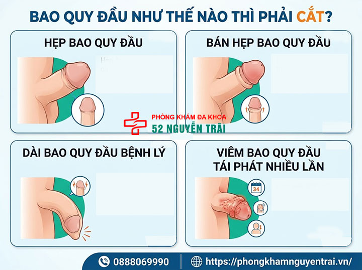 Có nên cắt bao quy đầu không? Khi nào cần thực hiện? 2 Bao Quy Đầu Như Thế Nào Thì Phải Cắt