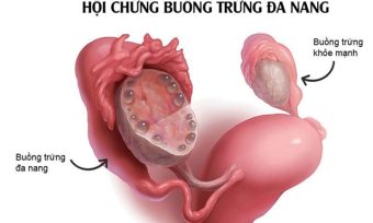 Buong trung da nang
