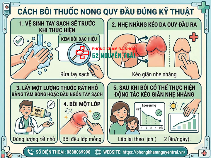 Thuốc Bôi Nong Bao Quy Đầu Cho Bé: Loại Nào, Bôi Sao Đúng? 3 Cách bôi thuốc nong quy đầu đúng kỹ thuật