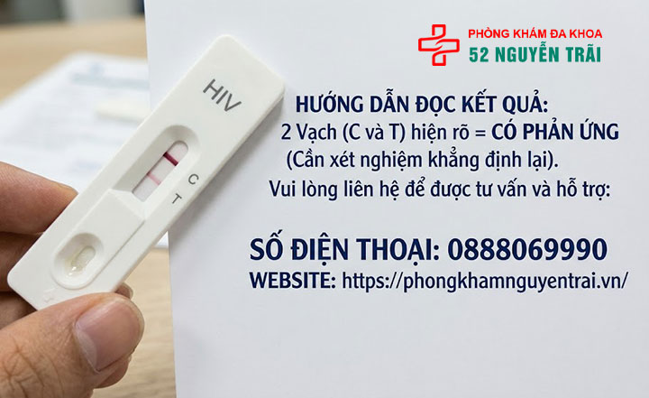 Xét nghiệm HIV tại nhà: Hướng dẫn dùng que thử, bộ kit 5 Cách đọc kết quả que xét nghiệm HIV