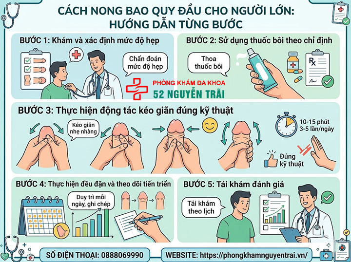 Cách Nong Bao Quy Đầu Cho Người Lớn An Toàn, Hiệu Quả 3 Cách nong bao quy đầu cho người lớn