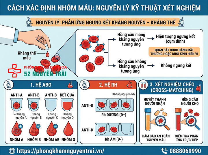 Xét nghiệm nhóm máu: Quy trình và cách đọc kết quả 4 Cách xác định nhóm máu: nguyên lý kỹ thuật xét nghiệm