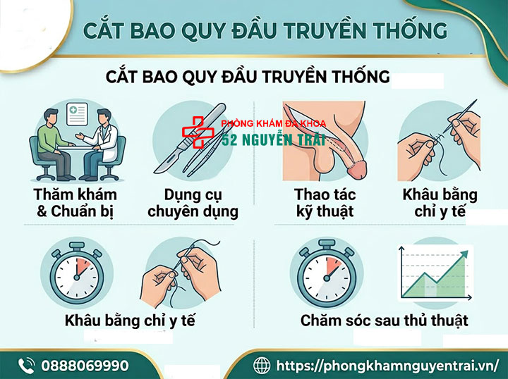 Cắt bao quy đầu bằng máy: Lợi ích và chi phí thực hiện 1 Cắt bao quy đầu truyền thống