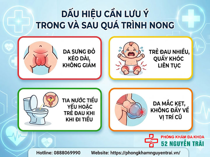 Chăm Sóc Trẻ Sau Khi Nong Bao Quy Đầu Đúng Cách 5 Dấu hiệu cần lưu ý trong và sau quá trình nong