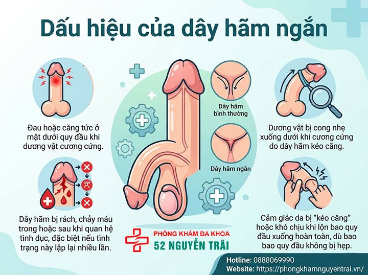 Cắt Dây Hãm Bao Quy Đầu: Khi Nào Cần Và Có Đau Không? 2 Dấu hiệu của dây hãm ngắn