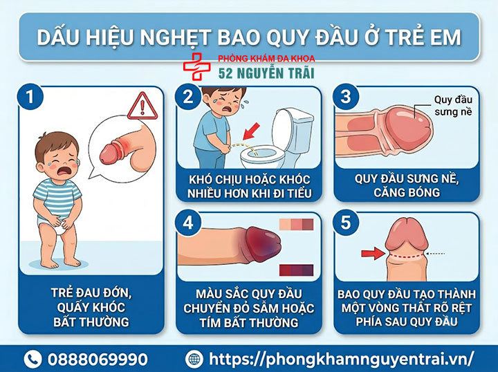 Nghẹt bao quy đầu ở trẻ em và người lớn: Dấu hiệu nguy hiểm cần biết 2 Dấu hiệu Nghẹt bao quy đầu ở trẻ em