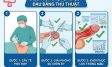 Nghẹt bao quy đầu ở trẻ em và người lớn: Dấu hiệu nguy hiểm cần biết
