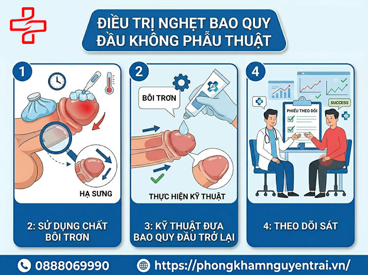Nghẹt bao quy đầu ở trẻ em và người lớn: Dấu hiệu nguy hiểm cần biết 7 Điều trị nghẹt bao quy đầu không phẫu thuật