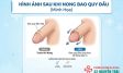Hình Ảnh Sau Khi Nong Bao Quy Đầu: Cha Mẹ Cần Biết Gì?