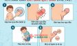 Cắt Bao Quy Đầu Cho Trẻ: Khi Nào Cần Và Độ Tuổi Phù Hợp