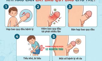 Khi nào cần cắt bao quy đầu cho trẻ