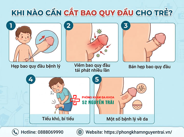 Cắt Bao Quy Đầu Cho Trẻ: Khi Nào Cần Và Độ Tuổi Phù Hợp 2 Khi nào cần cắt bao quy đầu cho trẻ