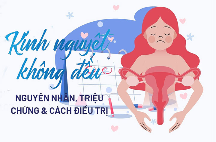 Kinh nguyệt không đều 1 Kinh nguyet khong deu