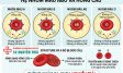 Các nhóm máu: Hệ A,B,O,AB phân loại và ý nghĩa