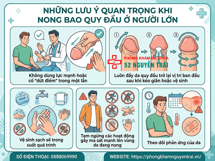 Cách Nong Bao Quy Đầu Cho Người Lớn An Toàn, Hiệu Quả 4 Những lưu ý quan trọng khi nong bao quy đầu ở người lớn