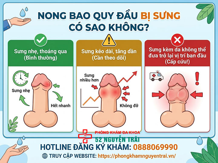 Hình Ảnh Sau Khi Nong Bao Quy Đầu: Cha Mẹ Cần Biết Gì? 3 Nong bao quy đầu bị sưng có sao không?