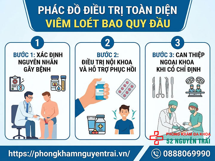 Thuốc trị viêm loét bao quy đầu: Các nhóm thuốc 3 Phác Đồ Điều Trị Toàn Diện viêm loét bao quy đầu