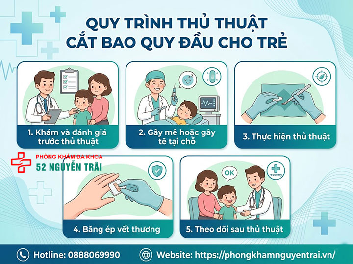 Cắt Bao Quy Đầu Cho Trẻ: Khi Nào Cần Và Độ Tuổi Phù Hợp 5 Quy trình thủ thuật cắt bao quy đầu cho trẻ