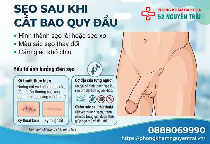 Cắt bao quy đầu có đau không, biến chứng thường gặp 7 Sẹo sau khi cắt bao quy đầu