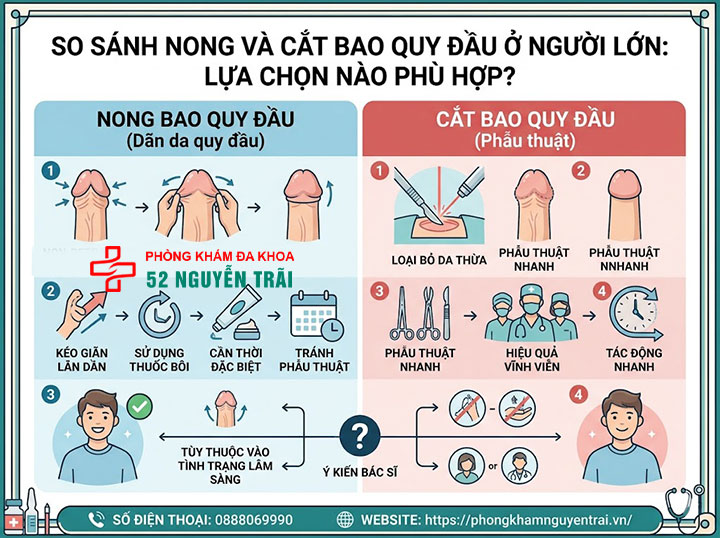 Cách Nong Bao Quy Đầu Cho Người Lớn An Toàn, Hiệu Quả 6 So sánh nong và cắt bao quy đầu ở người lớn: Lựa chọn nào phù hợp?