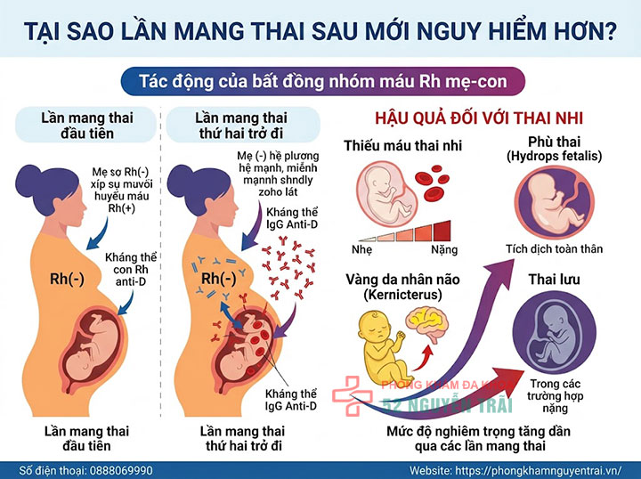 Bất đồng nhóm máu mẹ con: Nguy cơ & cách xử lý 3 Tại sao lần mang thai sau mới nguy hiểm hơn?