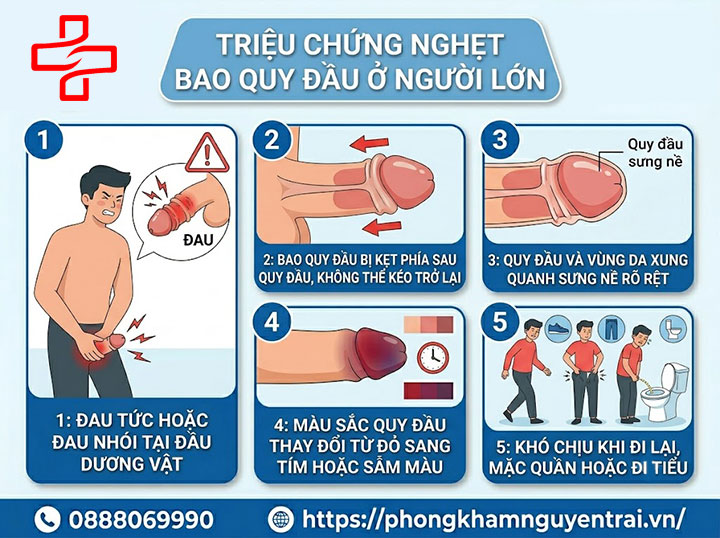 Nghẹt bao quy đầu ở trẻ em và người lớn: Dấu hiệu nguy hiểm cần biết 4 Triệu chứng Nghẹt bao quy đầu ở người lớn