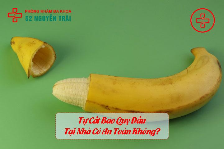 Tự Cắt Bao Quy Đầu Tại Nhà Có An Toàn Không? Sự Thật Về Phong Tục Cắt Bao Quy Đầu Trên Thế Giới 2 Tự Cắt Bao Quy Đầu Tại Nhà Có An Toàn Không?