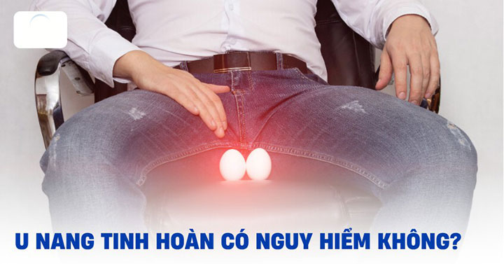 U nang tinh hoàn là gì? Dấu hiệu và cách điều trị 3 U nang tinh hoan co nguy hiem khong