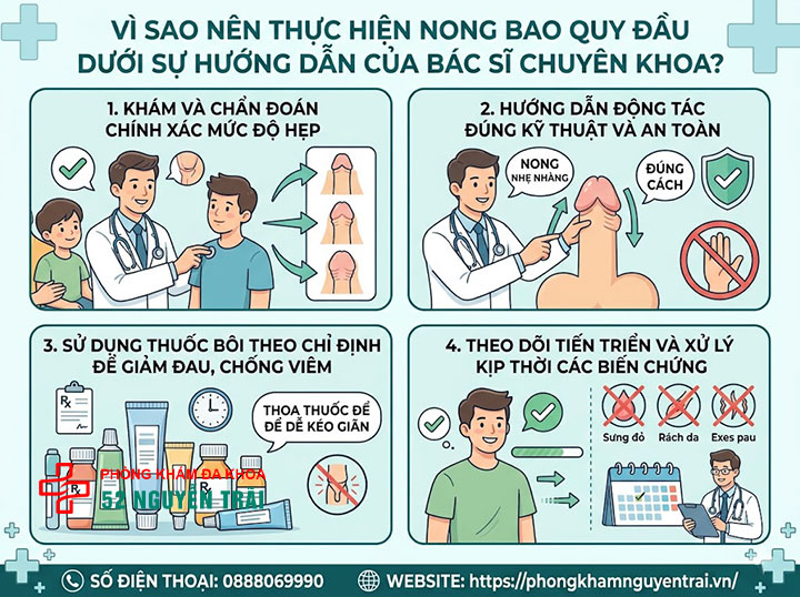 Cách Nong Bao Quy Đầu Cho Người Lớn An Toàn, Hiệu Quả 7 Vì sao nên thực hiện nong bao quy đầu dưới sự hướng dẫn của bác sĩ chuyên khoa?