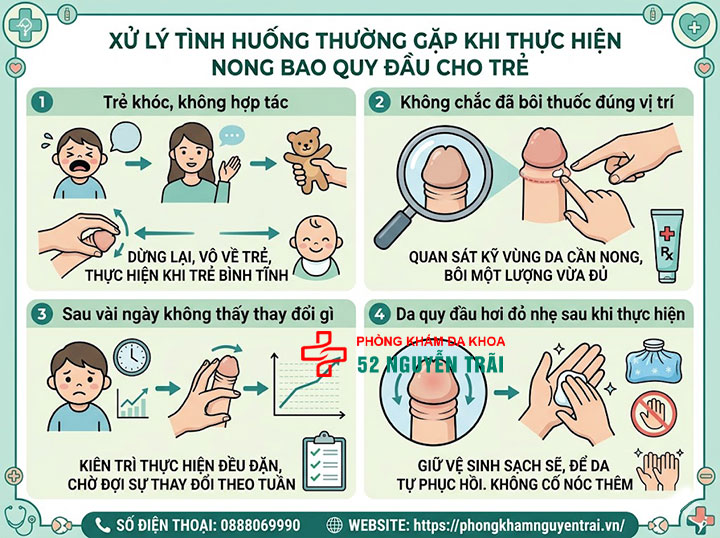 Hướng Dẫn Cách Nong Bao Quy Đầu Cho Bé Tại Nhà Từng Bước 5 Xử lý một số tình huống thường gặp trong quá trình thực hiện nong quy đầu