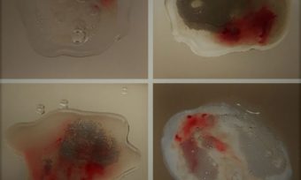 Xuất tinh ra máu: Nguyên nhân, dấu hiệu và cách điều trị an toàn